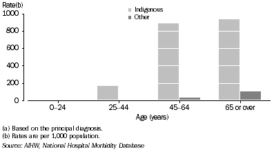 Graph: Female rates of hospitalisation for care involving dialysis(a), by Indigenous status—2003–04